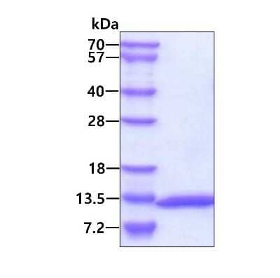 SDS-PAGE: Recombinant Human UBL5 His Protein [NBP1-72328]